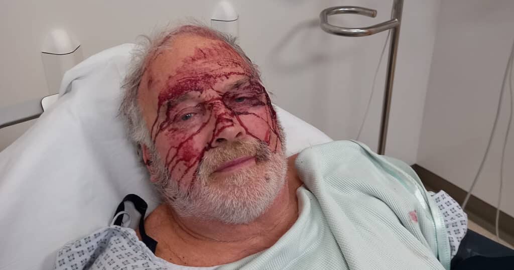 Weymouth Animal Rights monitor attacked with metal bar