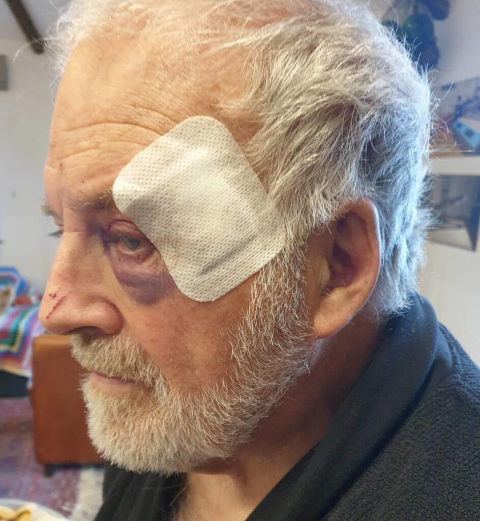 Weymouth Animal Rights monitor attacked with metal bar