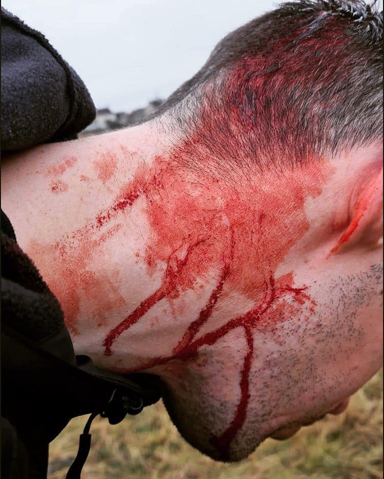 North Dorset Hunt Saboteur gets violently assaulted by BSV